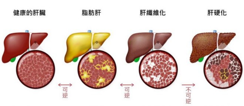 肝腎功能障礙患者用藥注意示意圖