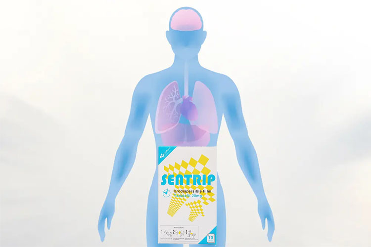 Sentrip口溶膜作用機制示意圖，說明Tadalafil如何透過血管擴張改善勃起功能
